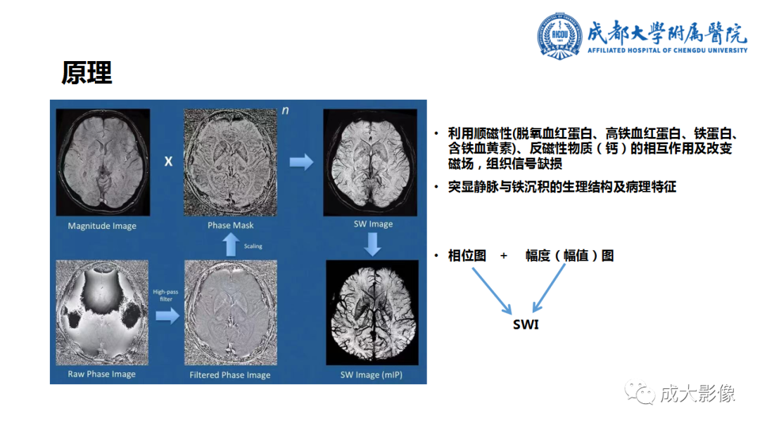 【PPT】SWI在中枢神经系统疾病中的应用-2