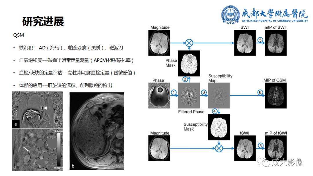 【PPT】SWI在中枢神经系统疾病中的应用-39