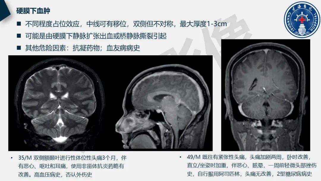 【PPT】低颅压综合征-31