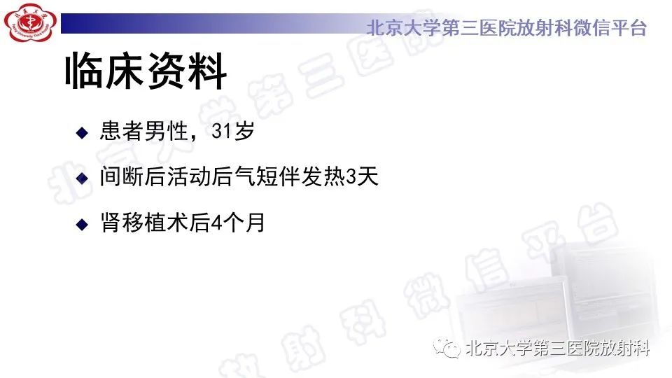 【PPT】病毒性肺炎-2