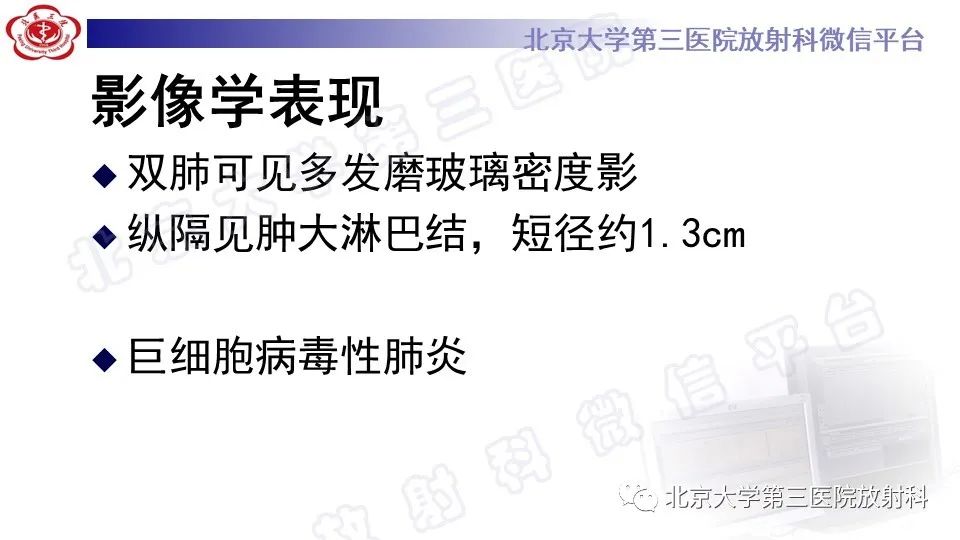 【PPT】病毒性肺炎-9