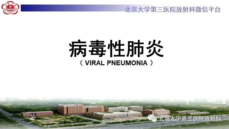 【PPT】病毒性肺炎-10