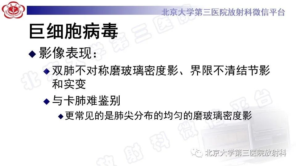 【PPT】病毒性肺炎-16