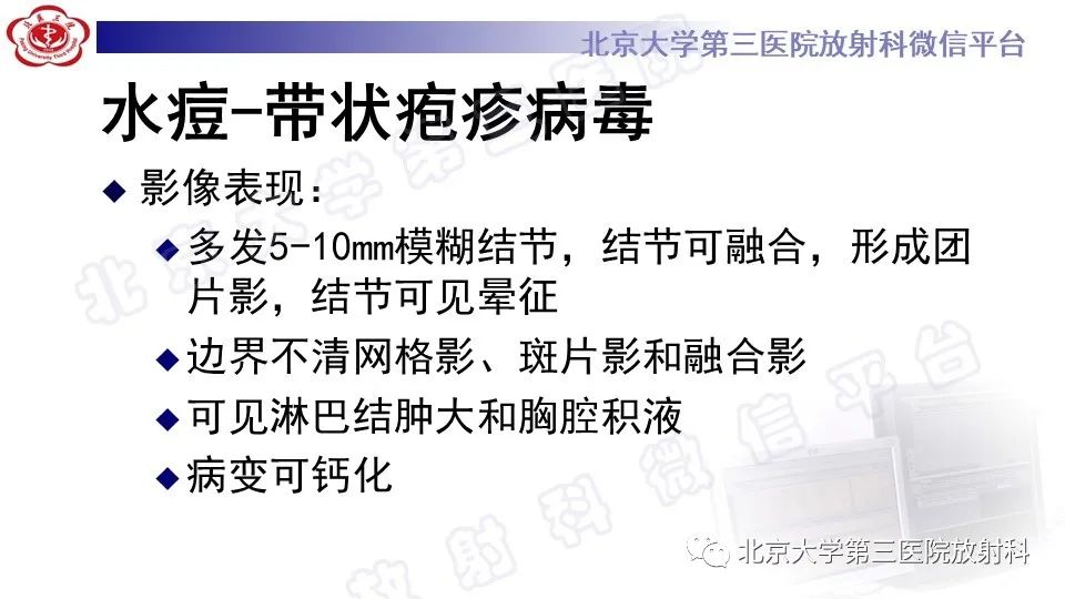 【PPT】病毒性肺炎-35