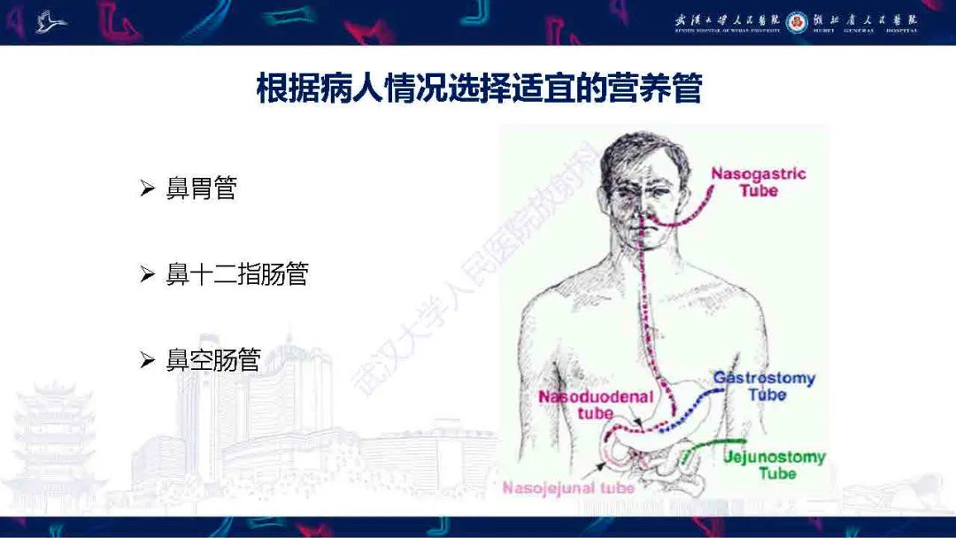 【PPT】胃肠营养管影像评估-4