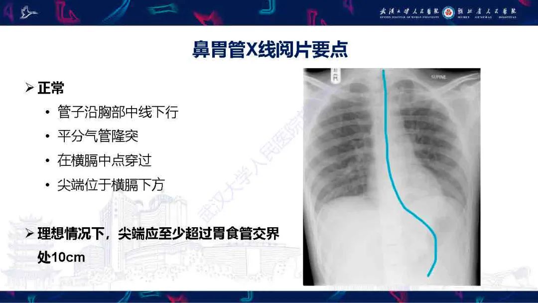 【PPT】胃肠营养管影像评估-6