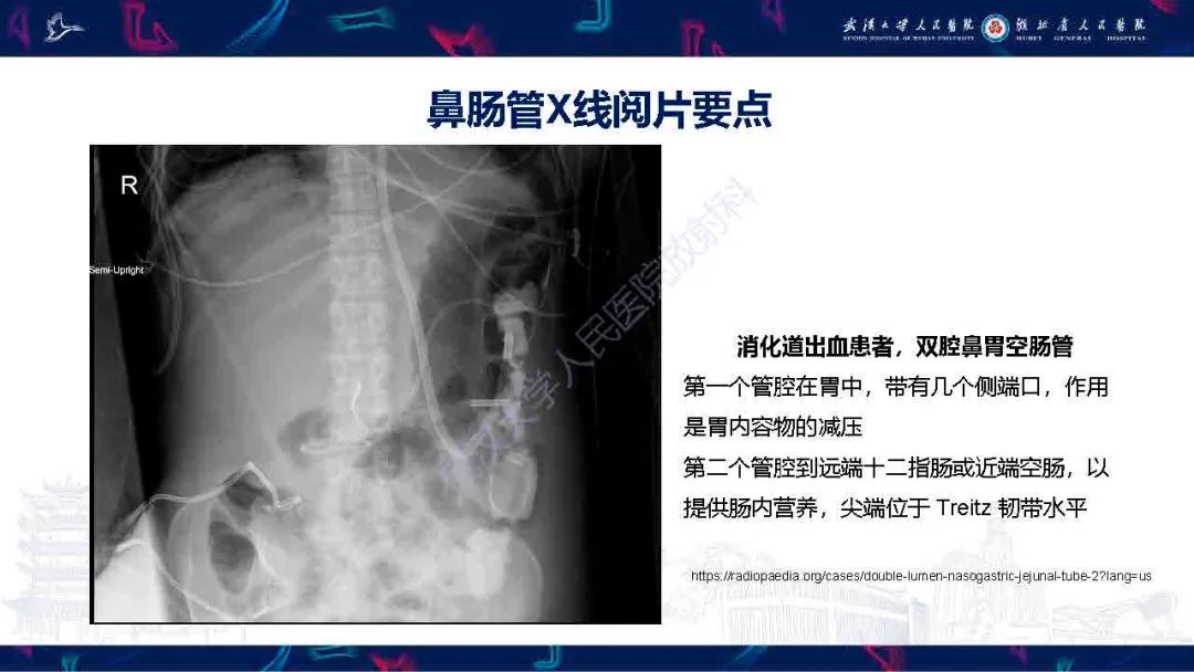 【PPT】胃肠营养管影像评估-15