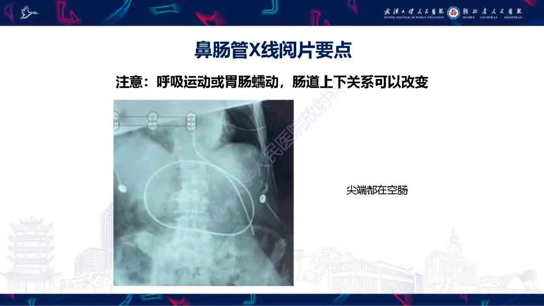 【PPT】胃肠营养管影像评估-14