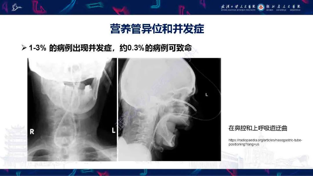 【PPT】胃肠营养管影像评估-16