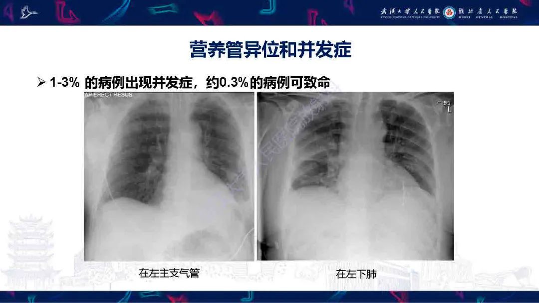 【PPT】胃肠营养管影像评估-19