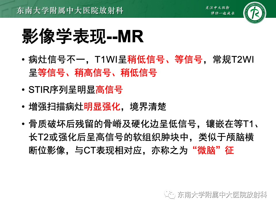 【PPT】骨孤立性浆细胞瘤-13