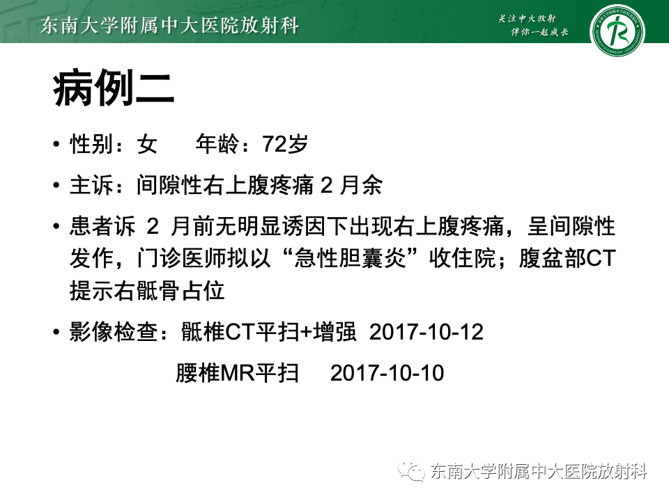 【PPT】骨孤立性浆细胞瘤-16