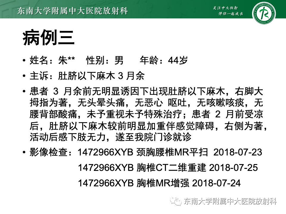 【PPT】骨孤立性浆细胞瘤-21