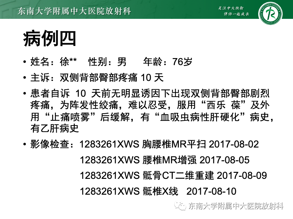 【PPT】骨孤立性浆细胞瘤-26