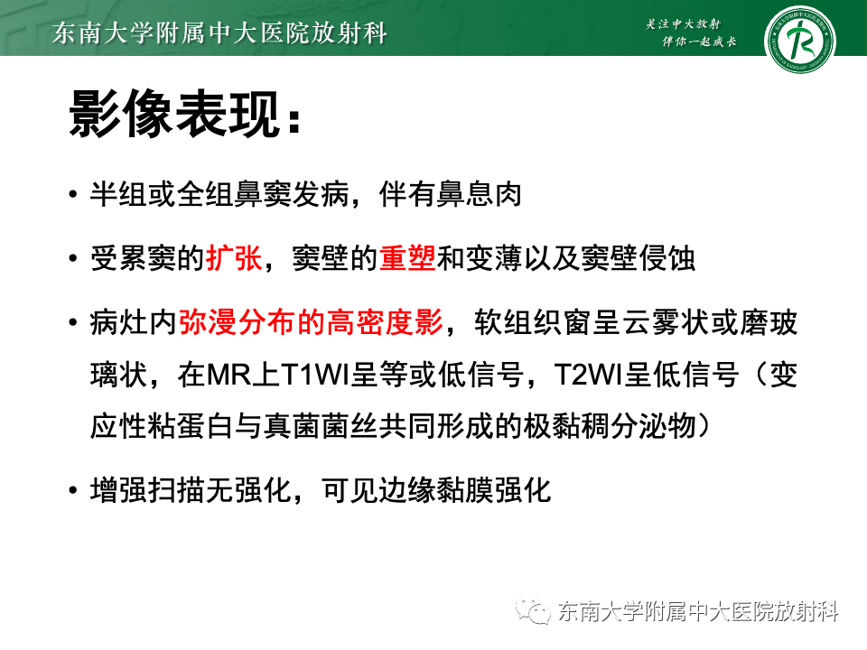 【PPT】真菌性鼻窦炎-12