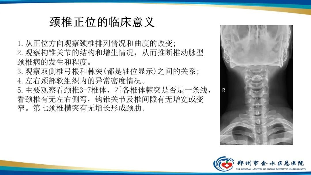 【PPT】颈椎拍片技术与临床意义-12