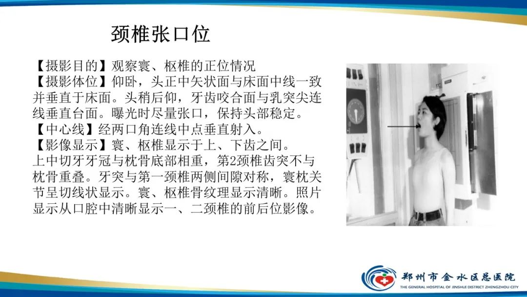 【PPT】颈椎拍片技术与临床意义-13