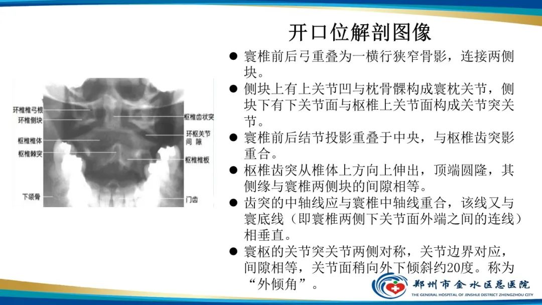 【PPT】颈椎拍片技术与临床意义-14
