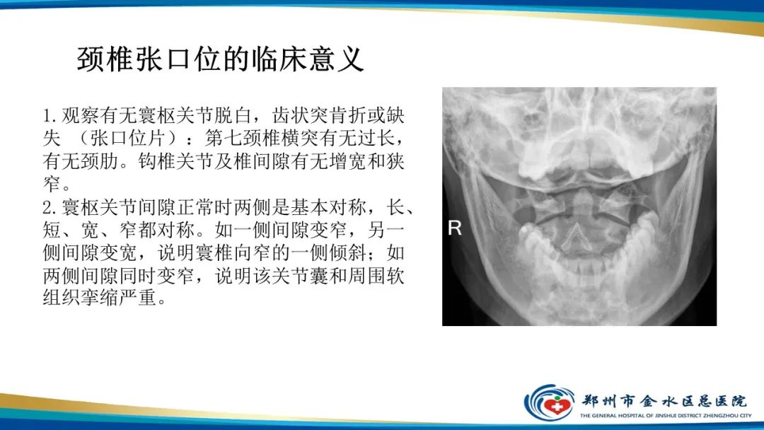 【PPT】颈椎拍片技术与临床意义-15