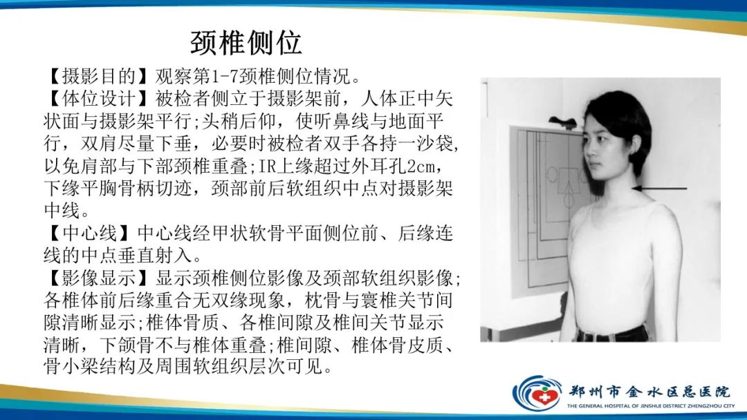 【PPT】颈椎拍片技术与临床意义-16