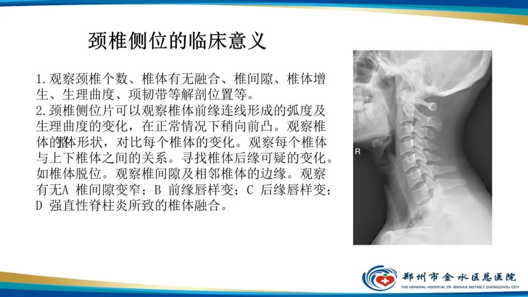 【PPT】颈椎拍片技术与临床意义-18