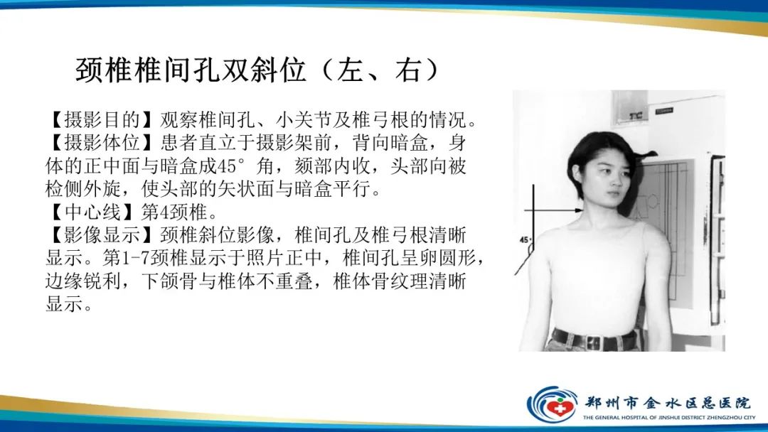 【PPT】颈椎拍片技术与临床意义-19