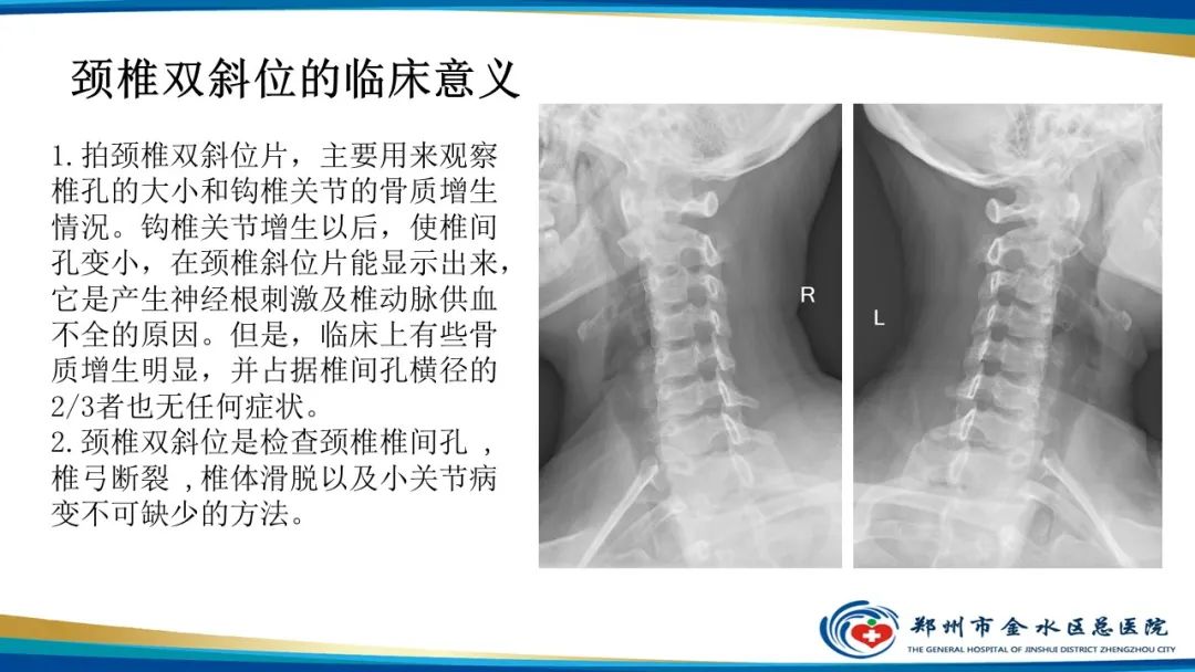 【PPT】颈椎拍片技术与临床意义-21