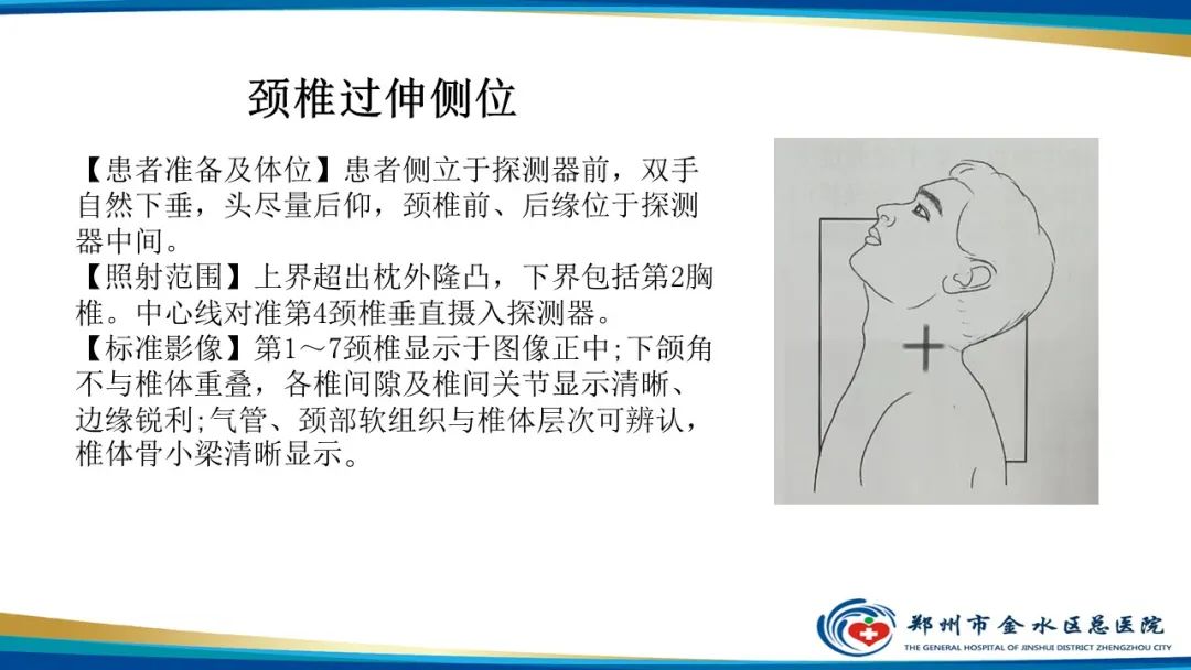 【PPT】颈椎拍片技术与临床意义-22