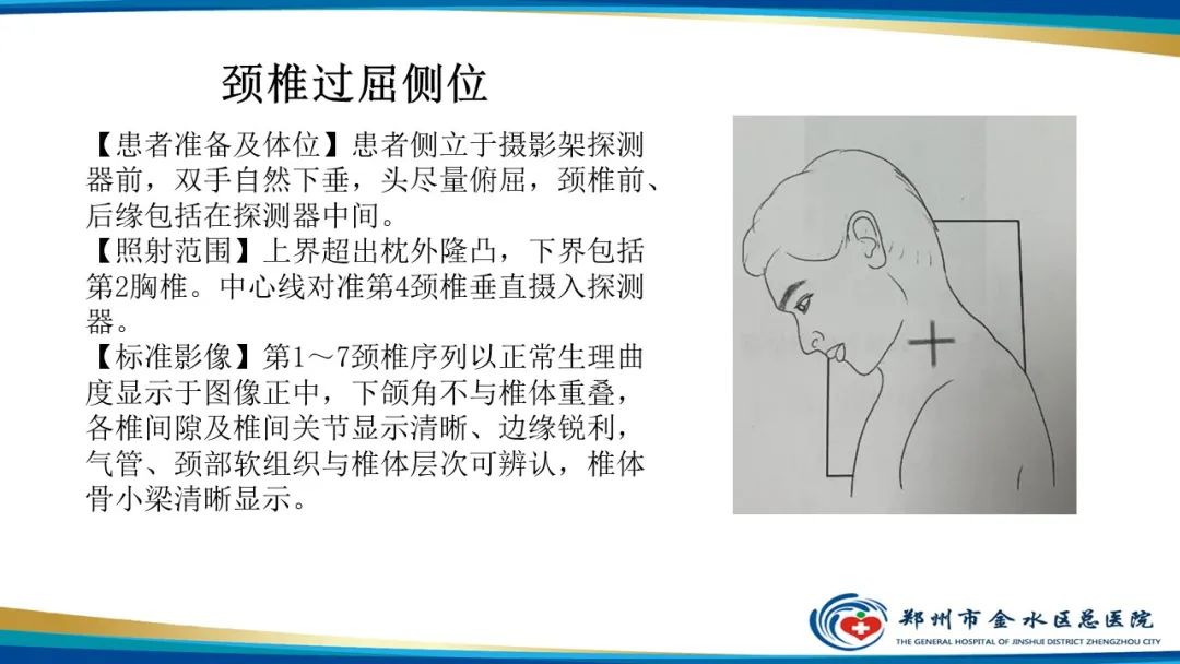 【PPT】颈椎拍片技术与临床意义-23