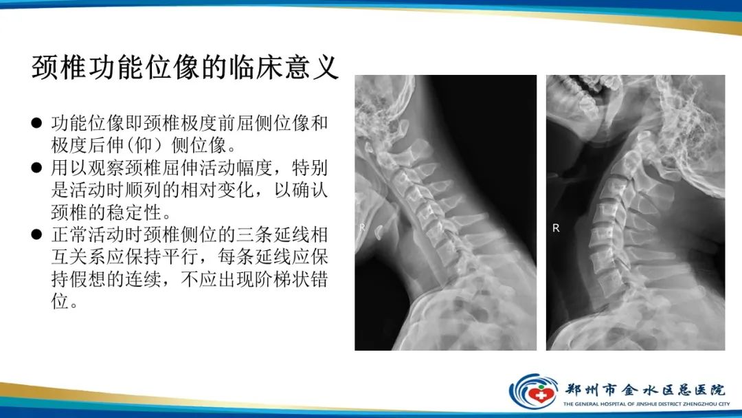 【PPT】颈椎拍片技术与临床意义-24