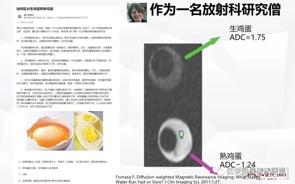 【PPT】磁共振弥散成像的原理及应用-5