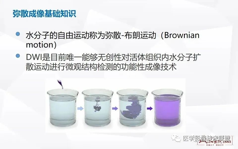 【PPT】磁共振弥散成像的原理及应用-6