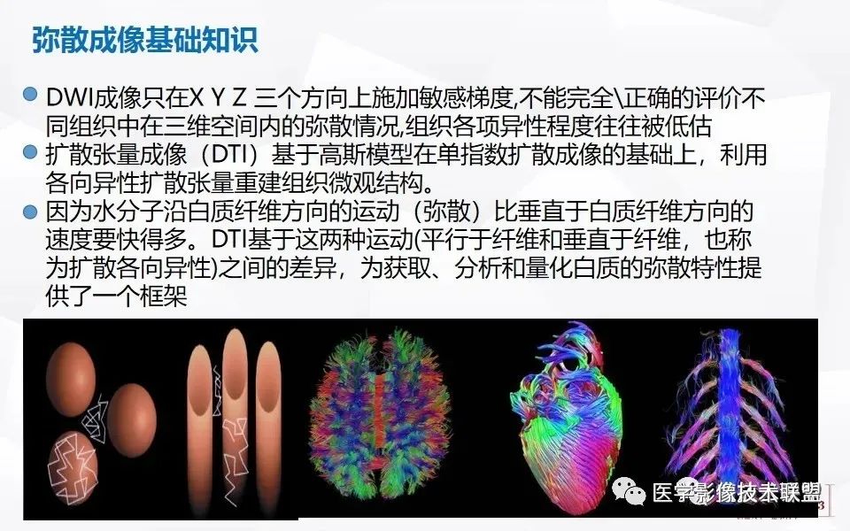 【PPT】磁共振弥散成像的原理及应用-8