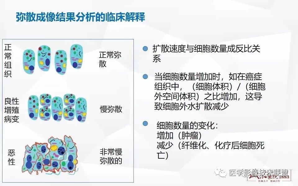 【PPT】磁共振弥散成像的原理及应用-16