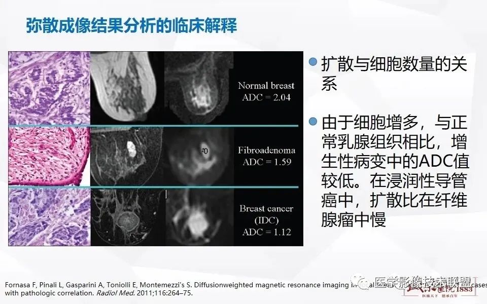 【PPT】磁共振弥散成像的原理及应用-17