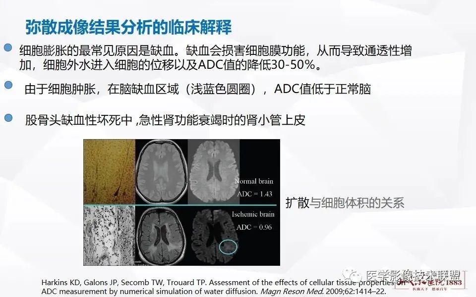【PPT】磁共振弥散成像的原理及应用-19