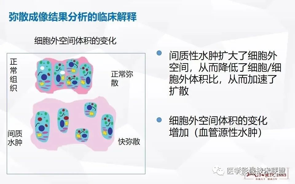 【PPT】磁共振弥散成像的原理及应用-20