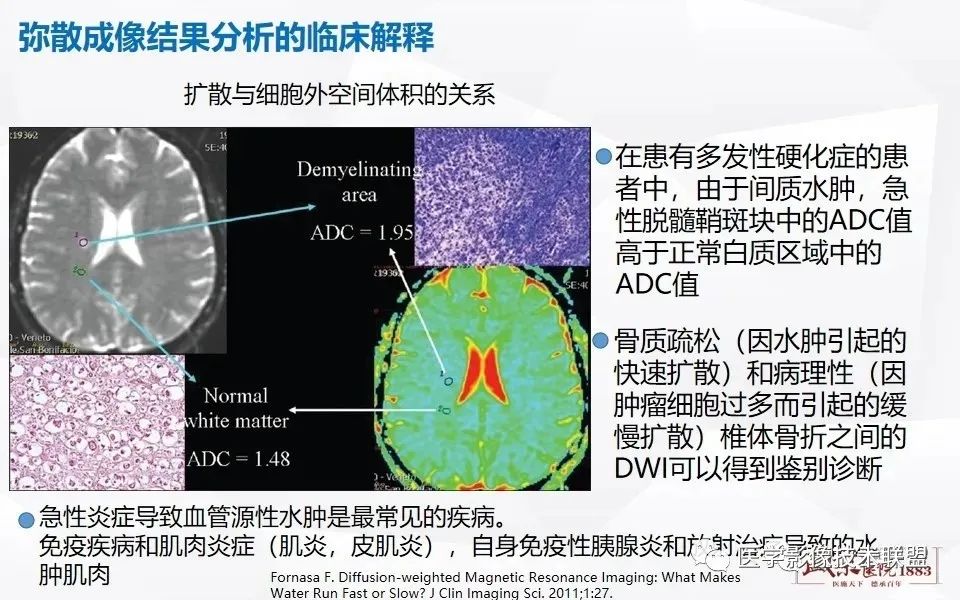 【PPT】磁共振弥散成像的原理及应用-21