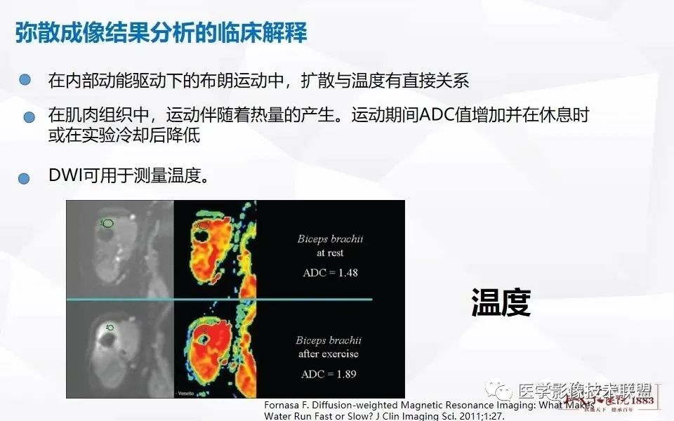 【PPT】磁共振弥散成像的原理及应用-24