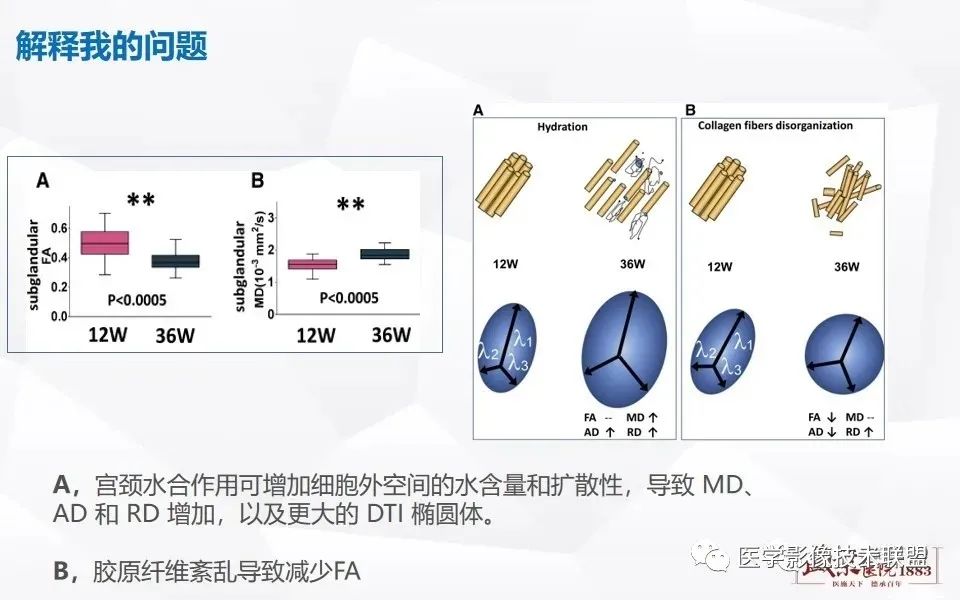 【PPT】磁共振弥散成像的原理及应用-25