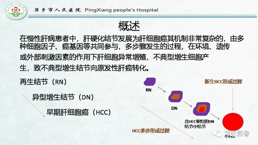 【PPT】HCC影像诊断思路-17