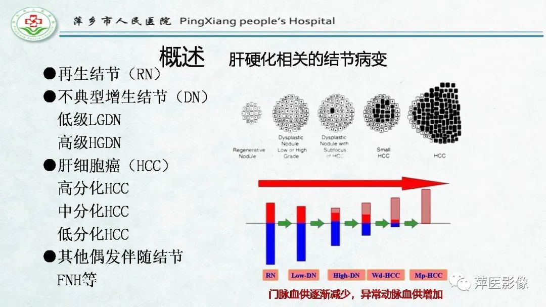 【PPT】HCC影像诊断思路-18