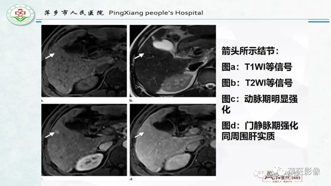 【PPT】HCC影像诊断思路-26