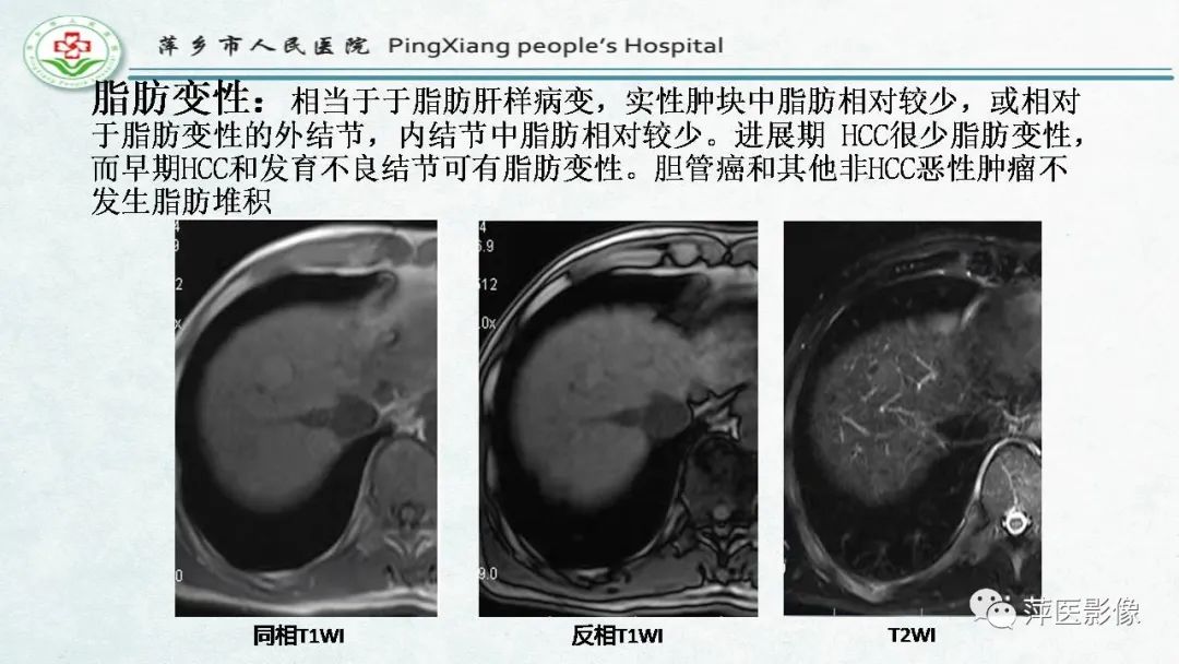 【PPT】HCC影像诊断思路-50
