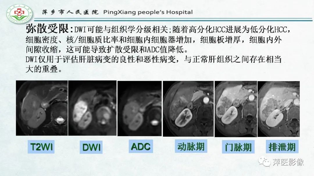 【PPT】HCC影像诊断思路-57