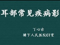 耳部常见疾病影像表现