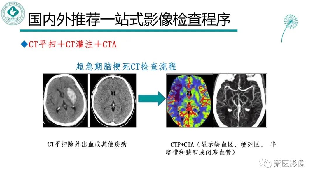 【PPT】脑灌注成像原理及在临床中的应用-6