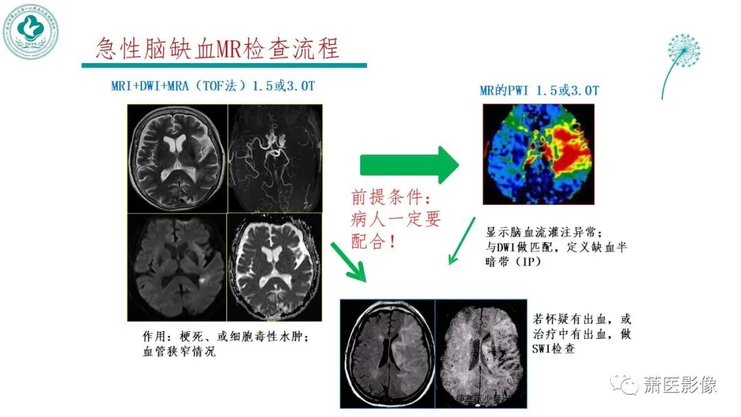 【PPT】脑灌注成像原理及在临床中的应用-7