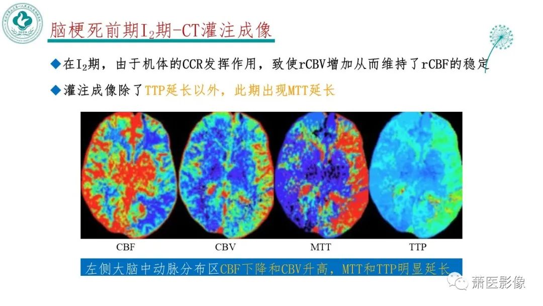 【PPT】脑灌注成像原理及在临床中的应用-18