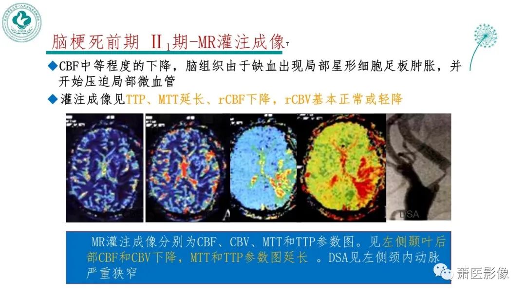 【PPT】脑灌注成像原理及在临床中的应用-19